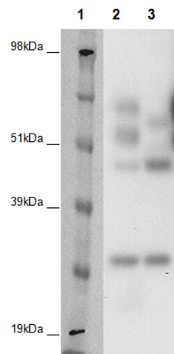 Eurofins Discoverx&nbsp;PathHunter CHO-K1 GPR150 β-Arrestin Orphan GPCR Cell Line, 2 vials. (93-0375C2A)