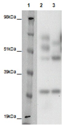 Eurofins Discoverx&nbsp;PathHunter eXpress GPR150 CHO-K1 β-Arrestin Orphan GPCR Assay, 2-Plate Kit. (93-0375E2ACP1M)