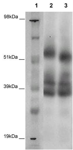 Eurofins Discoverx PathHunter CHO-K1 GPR37L1 β-Arrestin Orphan GPCR Cell