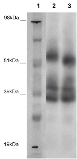 Eurofins Discoverx&nbsp;PathHunter eXpress GPR37L1 CHO-K1 β-Arrestin Orphan GPCR Assay, 2-Plate Kit. (93-0378E2ACP1M)