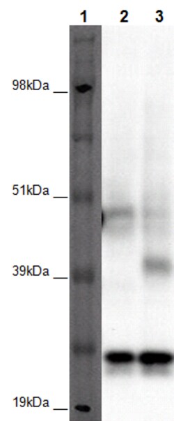Eurofins Discoverx&nbsp;PathHunter HEK 293 GPR173 β-Arrestin Orphan GPCR Cell Line, 2 vials. (93-0380C1A)