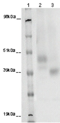Eurofins Discoverx&nbsp;PathHunter eXpress GPR173 CHO-K1 β-Arrestin Orphan GPCR Assay, 10-Plate Kit. (93-0380E2ACP1L)