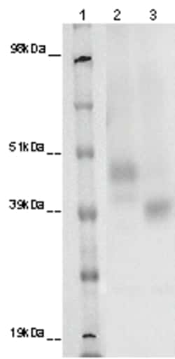 Eurofins Discoverx&nbsp;PathHunter eXpress GPR173 CHO-K1 β-Arrestin Orphan GPCR Assay, 2-Plate Kit. (93-0380E2ACP1M)