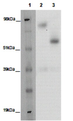 Eurofins Discoverx&nbsp;PathHunter eXpress GPR176 CHO-K1 β-Arrestin Orphan GPCR Assay, 2-Plate Kit. (93-0382E2ACP1M)