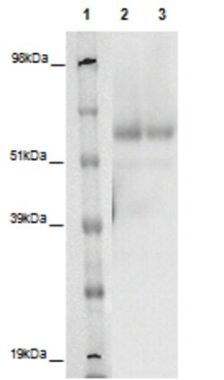 Eurofins Discoverx&nbsp;PathHunter eXpress GPR162 CHO-K1 β-Arrestin Orphan GPCR Assay, 2-Plate Kit. (93-0383E2ACP1M)