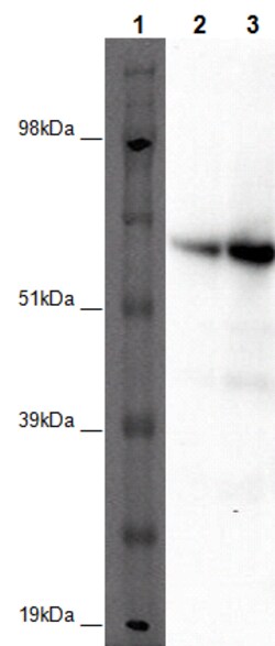 Eurofins Discoverx&nbsp;PathHunter HEK 293 GPR152 β-Arrestin Orphan GPCR Cell Line, 2 vials. (93-0384C1A)