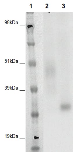 Eurofins Discoverx&nbsp;PathHunter CHO-K1 GPR141 β-Arrestin Orphan GPCR Cell Line, 2 vials. (93-0385C2A)