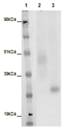 Eurofins Discoverx PathHunter eXpress GPR141 CHO-K1 β-Arrestin Orphan GPCR