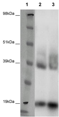 Eurofins Discoverx&nbsp;PathHunter eXpress GPR26 CHO-K1 β-Arrestin Orphan GPCR Assay, 10-Plate Kit. (93-0392E2ACP1L)