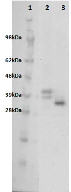 Eurofins Discoverx&nbsp;PathHunter CHO-K1 GPR31 β-Arrestin Orphan GPCR Cell Line, 2 vials. (93-0406C2)