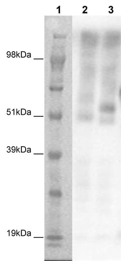 Eurofins Discoverx&nbsp;PathHunter CHO-K1 GPR61 β-Arrestin Orphan GPCR Cell Line, 2 vials. (93-0407C2A)