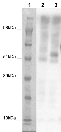 Eurofins Discoverx&nbsp;PathHunter eXpress GPR61 CHO-K1 β-Arrestin Orphan GPCR Assay, 10-Plate Kit. (93-0407E2ACP1L)