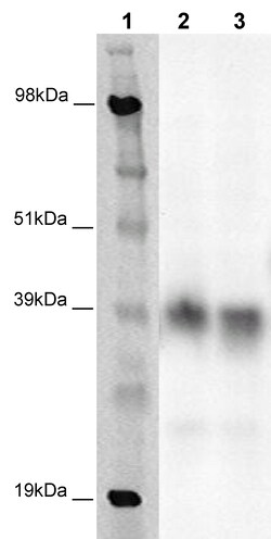 Eurofins Discoverx&nbsp;PathHunter CHO-K1 GPR79 β-Arrestin Orphan GPCR Cell Line, 2 vials. (93-0408C2A)