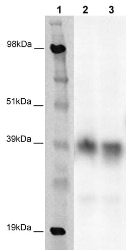 Eurofins Discoverx&nbsp;PathHunter eXpress GPR79 CHO-K1 β-Arrestin Orphan GPCR Assay, 10-Plate Kit. (93-0408E2ACP1L)