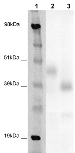 Eurofins Discoverx&nbsp;PathHunter CHO-K1 GPR85 β-Arrestin Orphan GPCR Cell Line, 2 vials. (93-0409C2A)