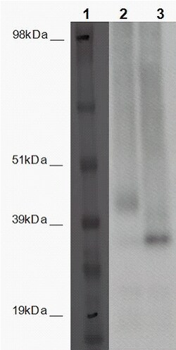 Eurofins Discoverx PathHunter U2OS GPR85 β-Arrestin Orphan GPCR Cell Line,