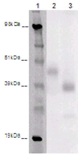 Eurofins Discoverx&nbsp;PathHunter eXpress GPR85 CHO-K1 β-Arrestin Orphan GPCR Assay, 10-Plate Kit. (93-0409E2ACP1L)