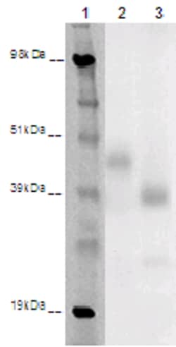 Eurofins Discoverx&nbsp;PathHunter eXpress GPR85 CHO-K1 β-Arrestin Orphan GPCR Assay, 2-Plate Kit. (93-0409E2ACP1M)