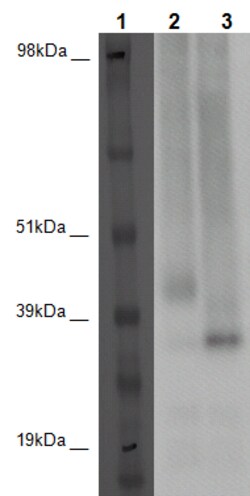 Eurofins Discoverx&nbsp;PathHunter eXpress GPR85 U2OS β-Arrestin Orphan GPCR Assay, 10-Plate Kit. (93-0409E3CP1L)