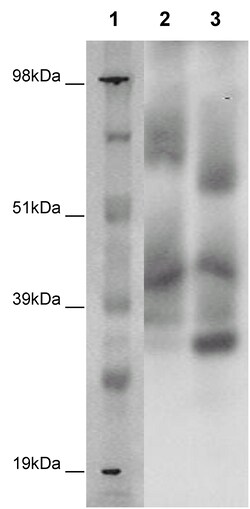 Eurofins Discoverx&nbsp;PathHunter eXpress GPR97 CHO-K1 β-Arrestin Orphan GPCR Assay, 10-Plate Kit. (93-0410E2ACP1L)