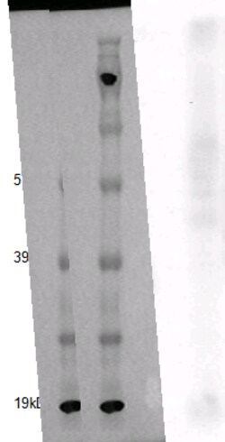 Eurofins Discoverx PathHunter CHO-K1 GPR132 β-Arrestin Orphan GPCR Cell Line, 2 vials. (93-0411C2A)