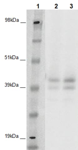 Eurofins Discoverx PathHunter CHO-K1 GPR142 β-Arrestin Orphan GPCR Cell