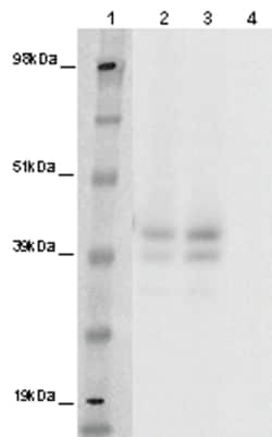 Eurofins Discoverx&nbsp;PathHunter eXpress GPR142 CHO-K1 β-Arrestin Orphan GPCR Assay, 10-Plate Kit. (93-0413E2ACP1L)
