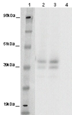 Eurofins Discoverx PathHunter eXpress GPR142 CHO-K1 β-Arrestin Orphan GPCR Assay, 2-Plate Kit. (93-0413E2ACP1M)