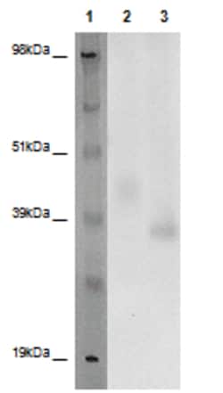 Eurofins Discoverx&nbsp;PathHunter eXpress GPR171 CHO-K1 β-Arrestin Orphan GPCR Assay, 10-Plate Kit. (93-0415E2ACP1L)