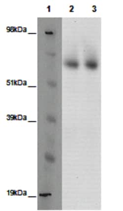 Eurofins Discoverx&nbsp;PathHunter eXpress GPR123 CHO-K1 β-Arrestin Orphan GPCR Assay, 10-Plate Kit. (93-0417E2ACP1L)