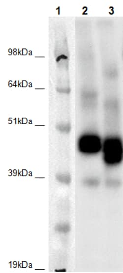 Eurofins Discoverx PathHunter CHO-K1 GPR107 β-Arrestin Orphan GPCR Cell