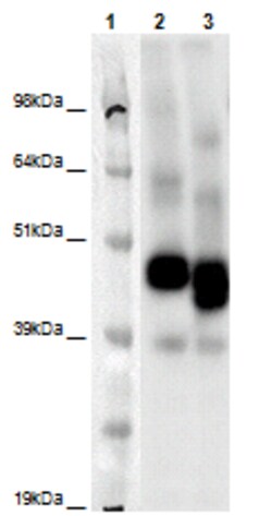 Eurofins Discoverx&nbsp;PathHunter eXpress GPR107 CHO-K1 β-Arrestin Orphan GPCR Assay, 2-Plate Kit. (93-0419E2ACP1M)