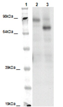 Eurofins Discoverx&nbsp;PathHunter eXpress GPR149 CHO-K1 β-Arrestin Orphan GPCR Assay, 10-Plate Kit. (93-0420E2ACP1L)