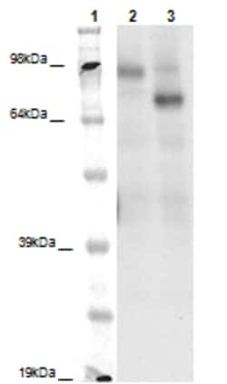 Eurofins Discoverx&nbsp;PathHunter eXpress GPR149 CHO-K1 β-Arrestin Orphan GPCR Assay, 2-Plate Kit. (93-0420E2ACP1M)