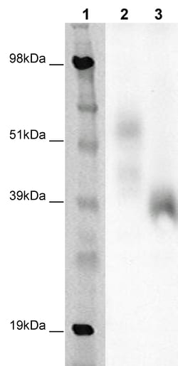 Eurofins Discoverx&nbsp;PathHunter eXpress GPR65 CHO-K1 β-Arrestin Orphan GPCR Assay, 2-Plate Kit. (93-0428E2ACP1M)