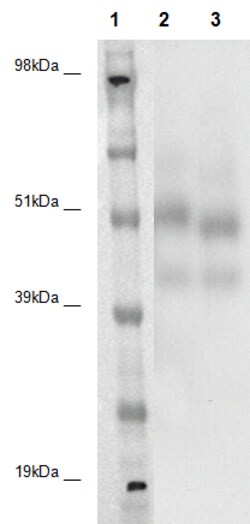 Eurofins Discoverx&nbsp;PathHunter CHO-K1 GPR135 (HUMNPIIY20) β-Arrestin Orphan GPCR Cell Line, 2 vials. (93-0431C2A)