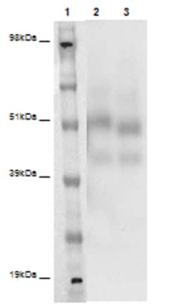 Eurofins Discoverx PathHunter eXpress GPR135 CHO-K1 β-Arrestin Orphan GPCR