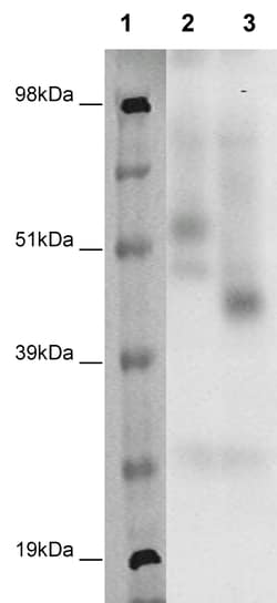 Eurofins Discoverx PathHunter CHO-K1 GPR83 (72) β-Arrestin Orphan GPCR