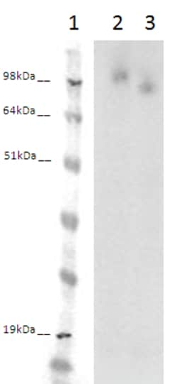 Eurofins Discoverx PathHunter eXpress LGR4 CHO-K1 β-Arrestin Orphan GPCR