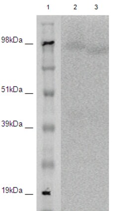Eurofins Discoverx&nbsp;PathHunter eXpress LGR5 CHO-K1 β-Arrestin Orphan GPCR Assay, 2-Plate Kit. (93-0526E2ACP1M)