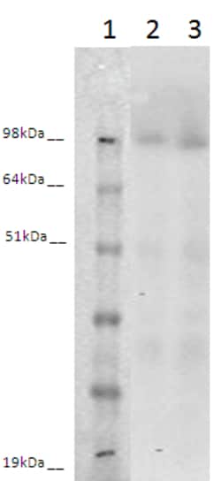 Eurofins Discoverx PathHunter CHO-K1 LGR6 β-Arrestin Orphan GPCR Cell Line,