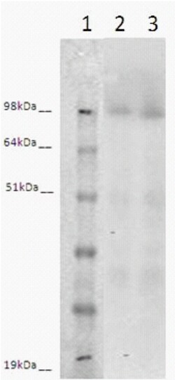 Eurofins Discoverx&nbsp;PathHunter eXpress LGR6 CHO-K1 β-Arrestin Orphan GPCR Assay, 2-Plate Kit. (93-0527E2ACP1M)