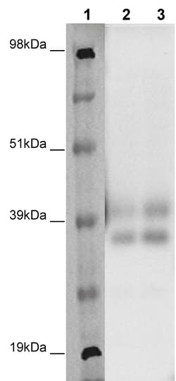 Eurofins Discoverx PathHunter CHO-K1 MRGPRX4 β-Arrestin Orphan GPCR Cell
