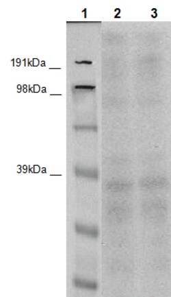 Eurofins Discoverx&nbsp;PathHunter CHO-K1 BAI2 β-Arrestin Orphan GPCR Cell Line, 2 vials. (93-0546C2)