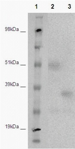 Eurofins Discoverx PathHunter eXpress DARC CHO-K1 β-Arrestin Orphan GPCR