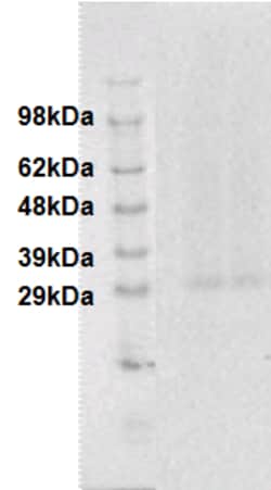 Eurofins Discoverx PathHunter eXpress GPR18 CHO-K1 β-Arrestin Orphan GPCR