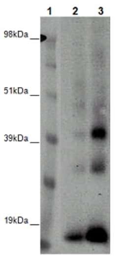 Eurofins Discoverx&nbsp;PathHunter CHO-K1 GPR6 β-Arrestin Orphan GPCR Cell Line, 2 vials. (93-0634C2)