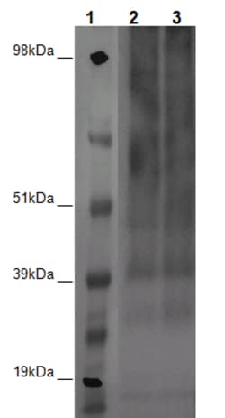 Eurofins Discoverx&nbsp;PathHunter U2OS GPR6 β-Arrestin Orphan GPCR Cell Line, 2 vials. (93-0634C3)