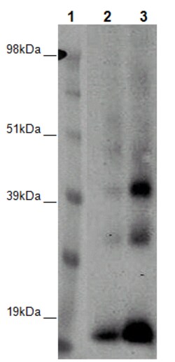 Eurofins Discoverx PathHunter eXpress GPR6 CHO-K1 β-Arrestin Orphan GPCR