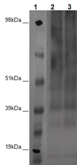 Eurofins Discoverx&nbsp;PathHunter eXpress GPR6 U2OS β-Arrestin Orphan GPCR Assay, 10-Plate Kit. (93-0634E3CP1L)